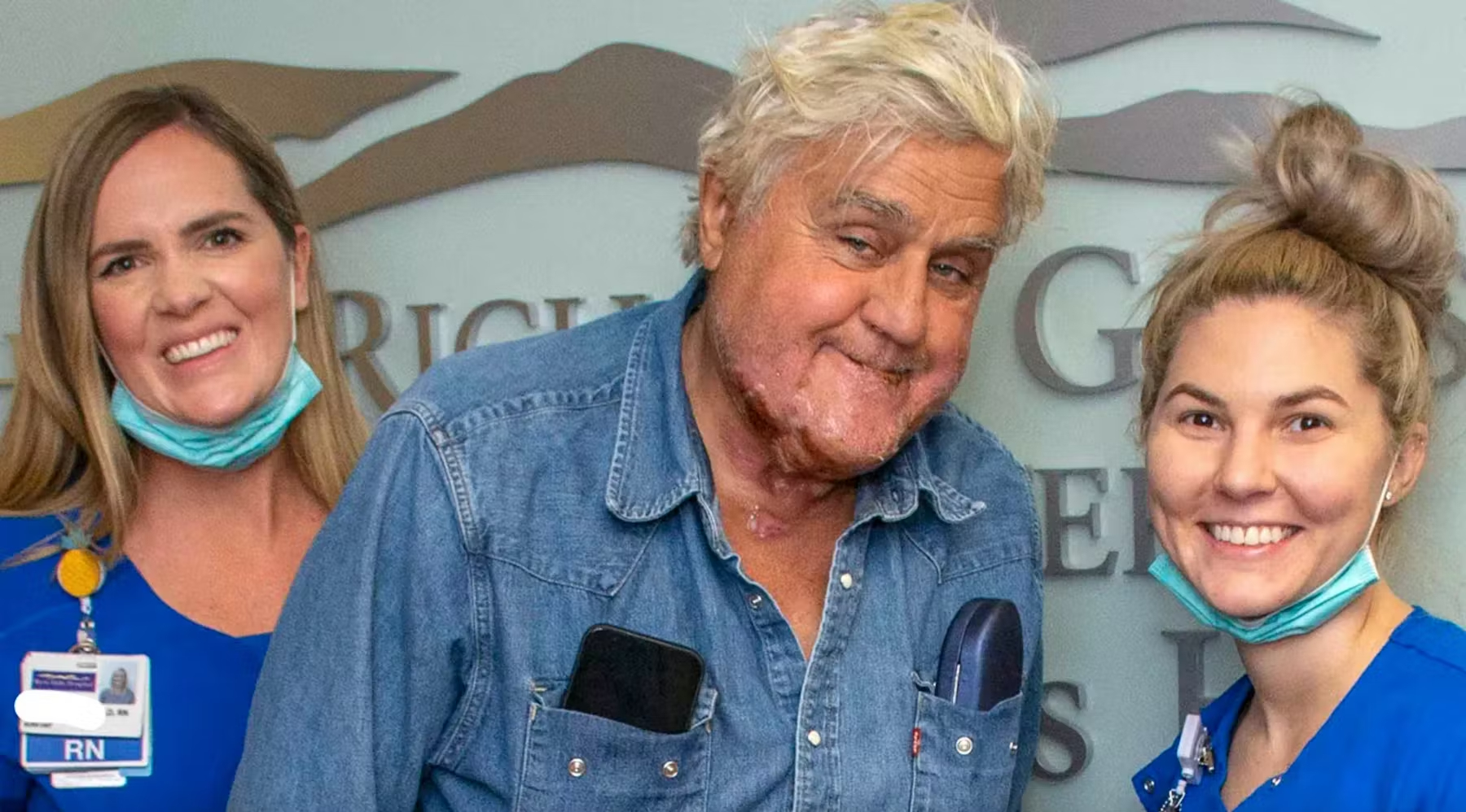 Jay Leno released from hospital after suffering second-degree burns
